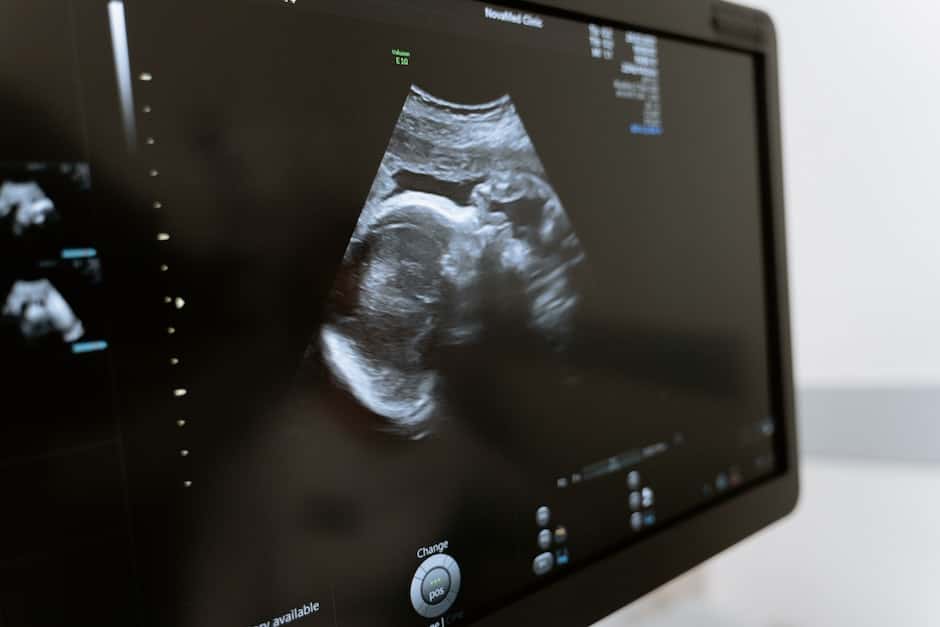 3d scanning, 3d ultrasound, analysis